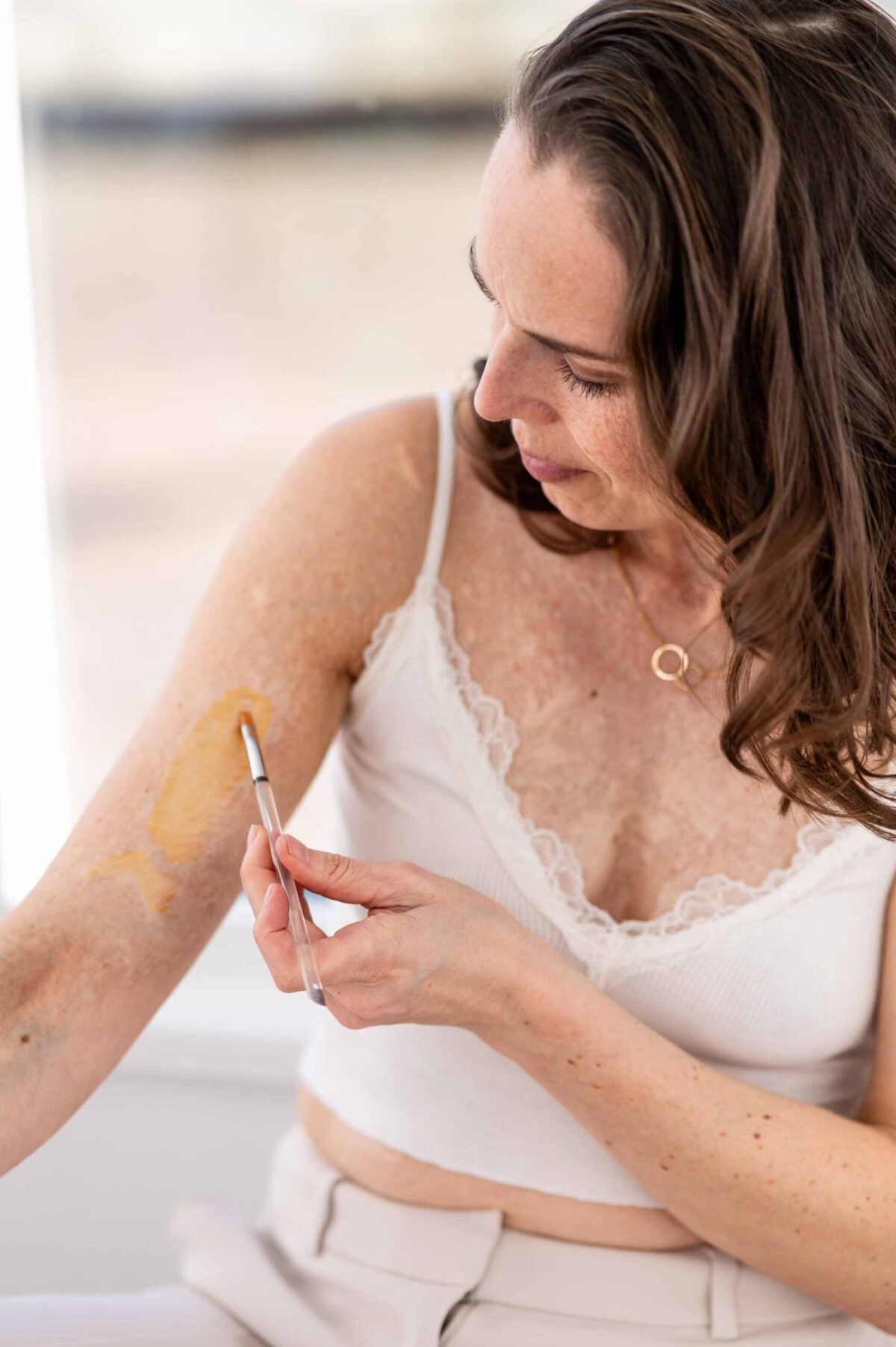 Juliane-Kluess-Narbenfotografie-3